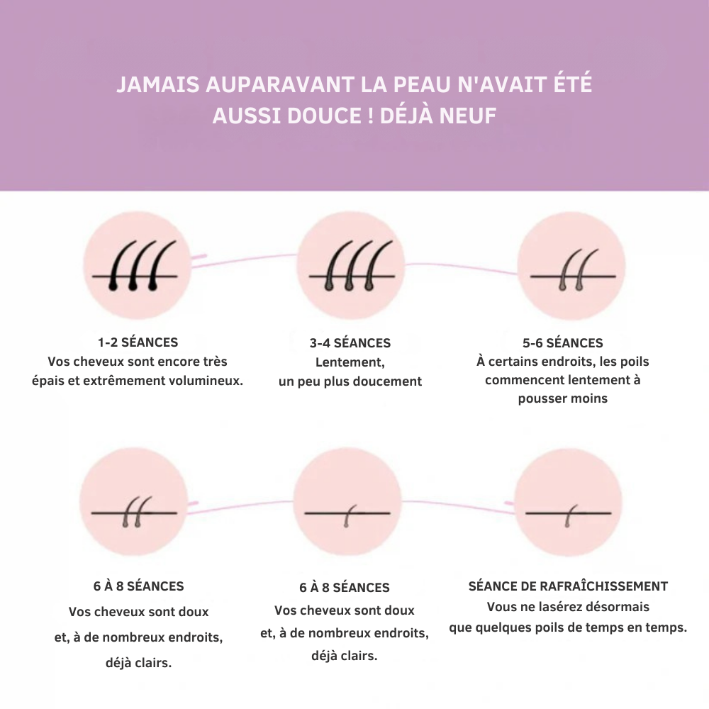 SmoothTouch IPL™ | Épilation permanente – technologie douce pour une peau lisse toute l'année