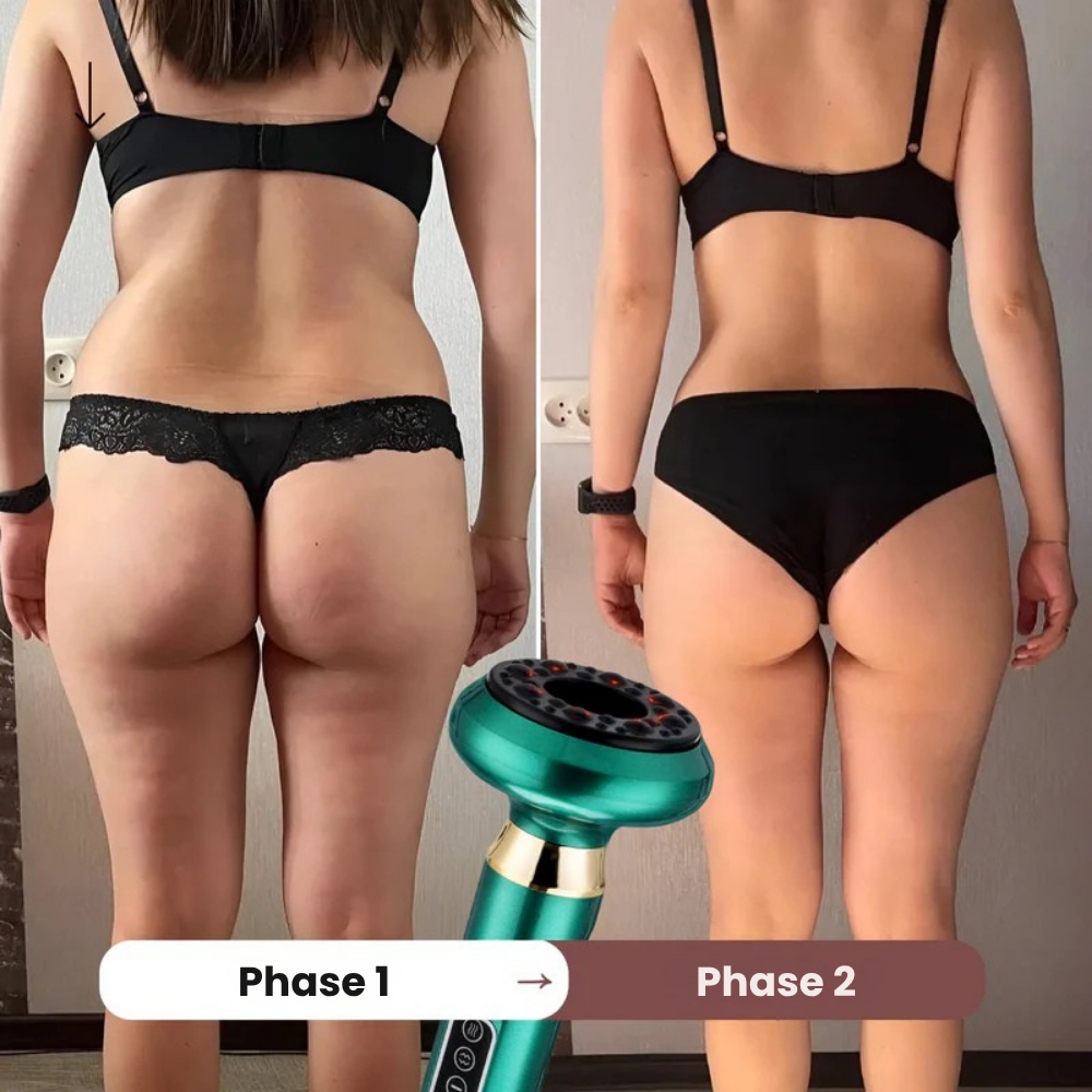 CelluSculpt™ | Découvrez une peau visiblement plus lisse et plus ferme