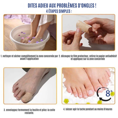 NailRepair™ | Pansement contre les mycoses des ongles