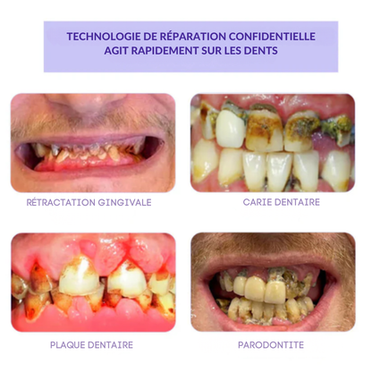 RénovaDent™ – La poudre minérale qui restaure l’émail et apaise la sensibilité