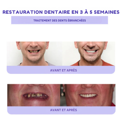 RénovaDent™ – La poudre minérale qui restaure l’émail et apaise la sensibilité