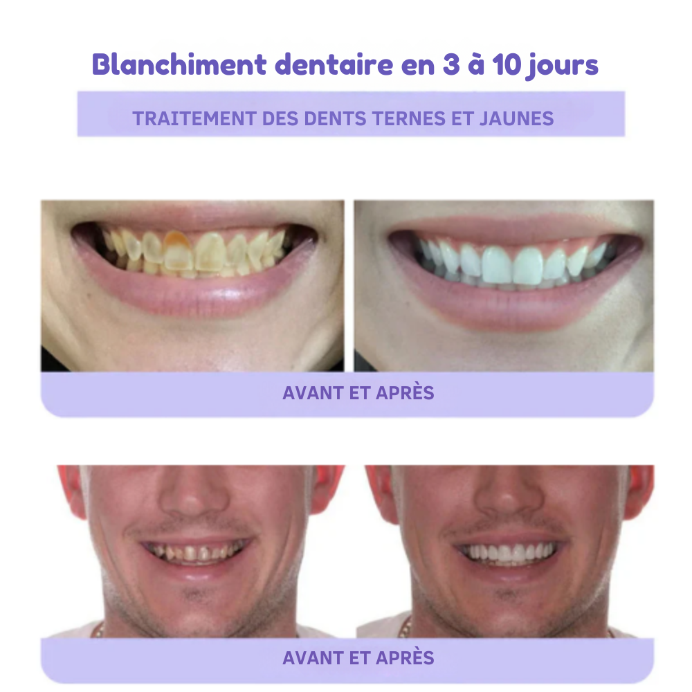 RénovaDent™ – La poudre minérale qui restaure l’émail et apaise la sensibilité