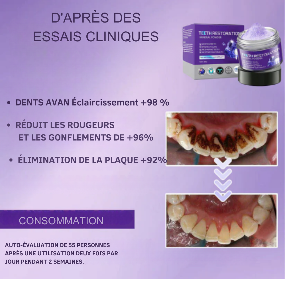 RénovaDent™ – La poudre minérale qui restaure l’émail et apaise la sensibilité