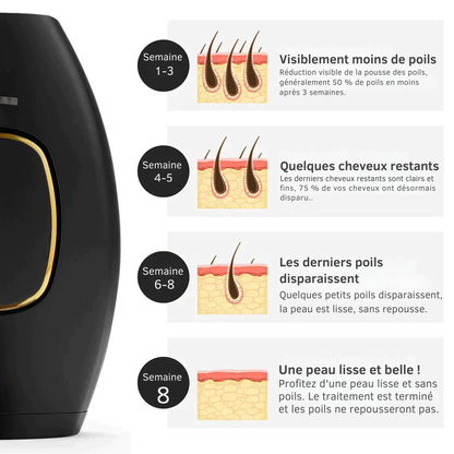 SmoothTouch IPL™ | Épilation permanente – technologie douce pour une peau lisse toute l'année