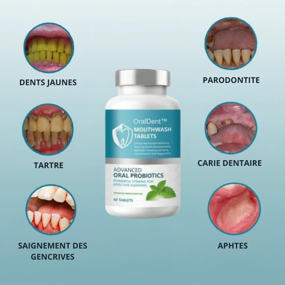 OralDent™ | Éliminez le tartre et blanchissez vos dents sans aller chez le dentiste