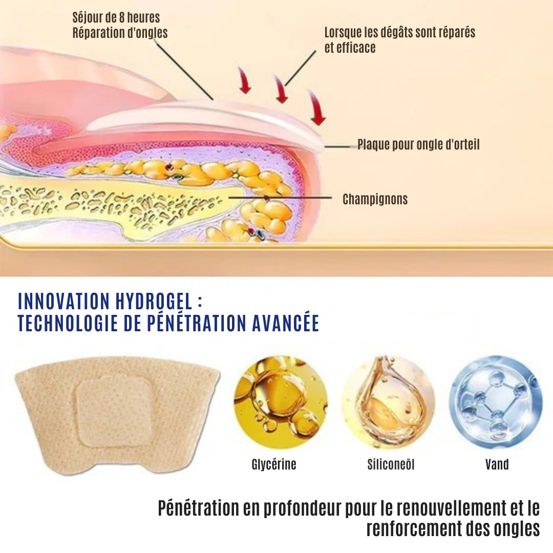 NailRepair™ | Pansement contre les mycoses des ongles