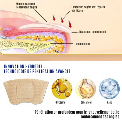 NailRepair™ | Pansement contre les mycoses des ongles