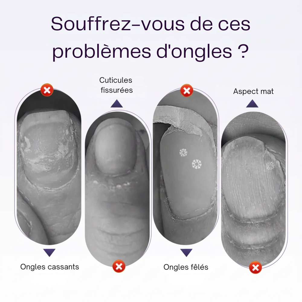 ManiLisse™ – Des cuticules nettes et soignées sans ciseaux ni douleur