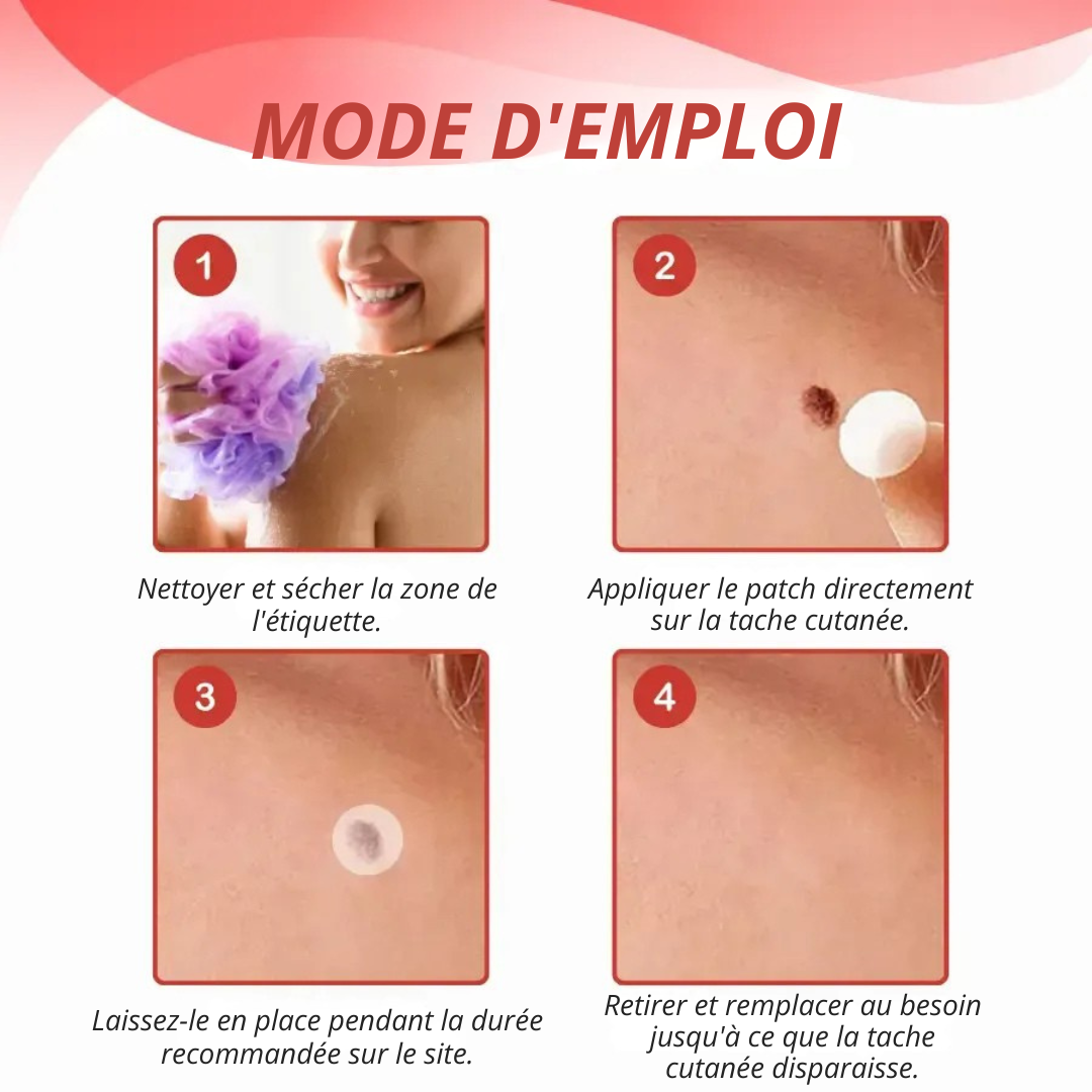 DermaPatch™ | Enlever les grains de beauté pendants sans douleur - pas de cicatrices, pas de coupures, pas de stress !