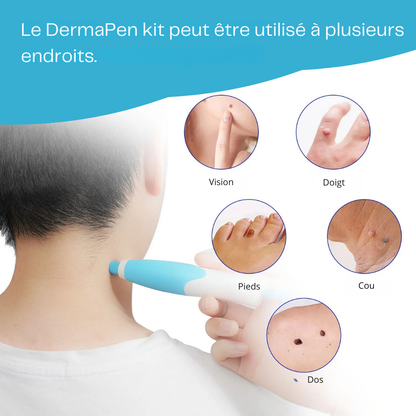 DermoPen™ Kit | Éliminez facilement et en douceur les marques de peau – chez vous
