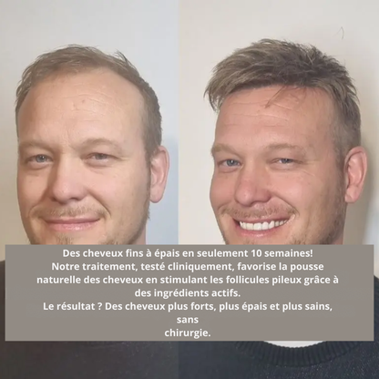 Régencis™ | Le sérum scientifique qui réactive la croissance et redonne force et densité