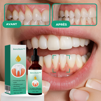 GenciSoin™ | Arrêtez les gencives qui saignent et restaurez la santé de votre bouche – naturellement