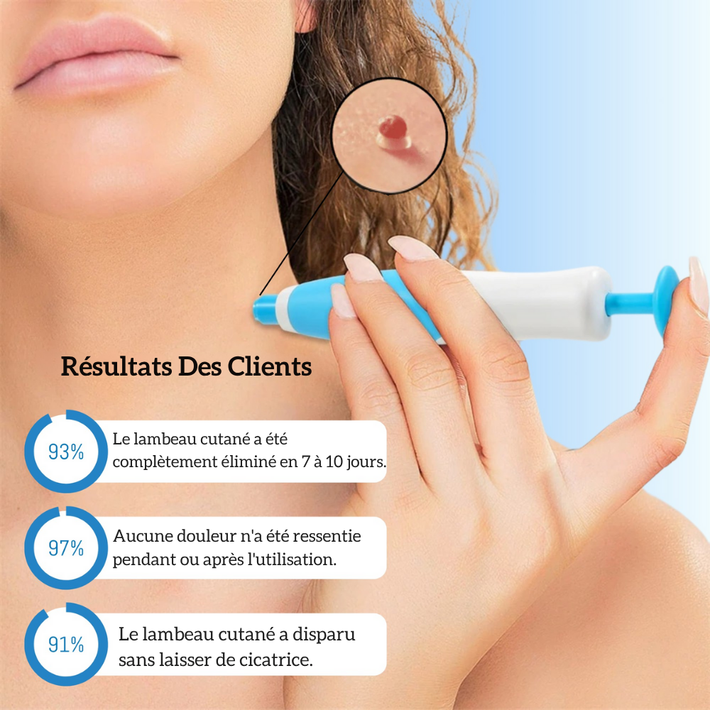DermaTag™ | Retrouver une peau lisse et dire adieu aux acrochordons