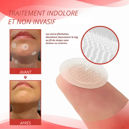 DermaPatch™ | Enlever les grains de beauté pendants sans douleur - pas de cicatrices, pas de coupures, pas de stress !