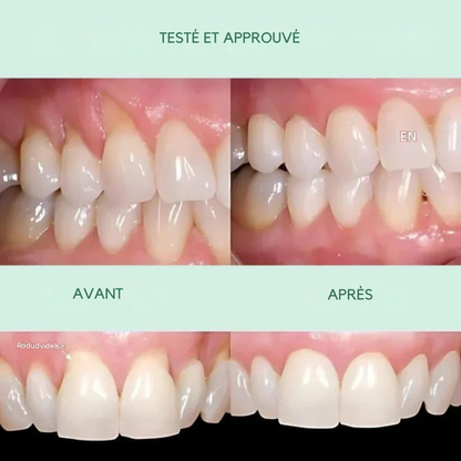 GenciSoin™ | Arrêtez les gencives qui saignent et restaurez la santé de votre bouche – naturellement