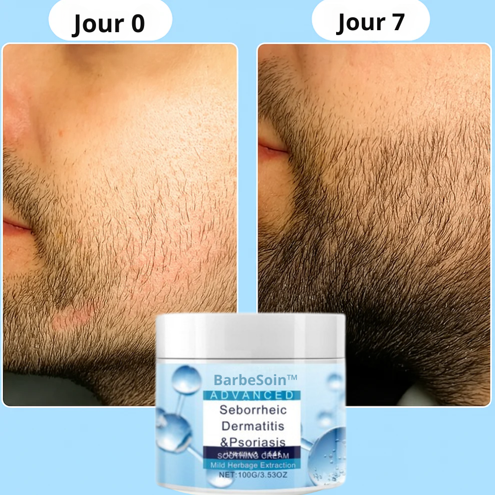 BarbeSoin™ | Ensemble de soins pour la barbe premium – Dites adieu aux démangeaisons et à l'irritation, et obtenez une barbe saine et bien entretenue