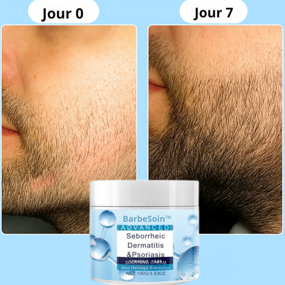 BarbeSoin™ | Ensemble de soins pour la barbe premium – Dites adieu aux démangeaisons et à l'irritation, et obtenez une barbe saine et bien entretenue