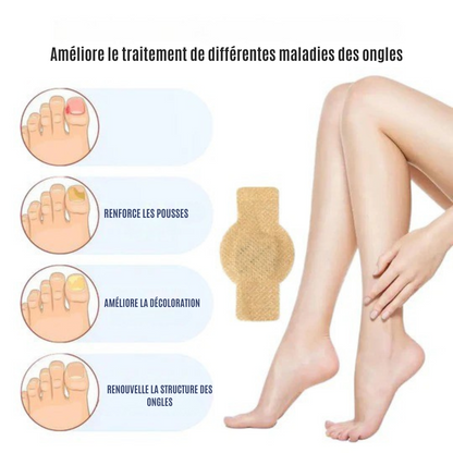 NailRepair™ | Pansement contre les mycoses des ongles