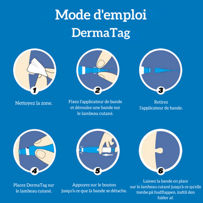 DermaTag™ | Retrouver une peau lisse et dire adieu aux acrochordons
