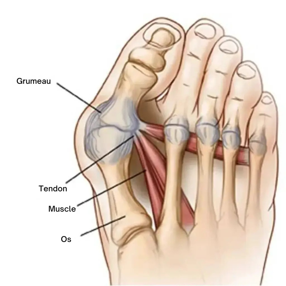 AlignOrteil™ | Rétablissez l'équilibre naturel de vos pieds sans intervention