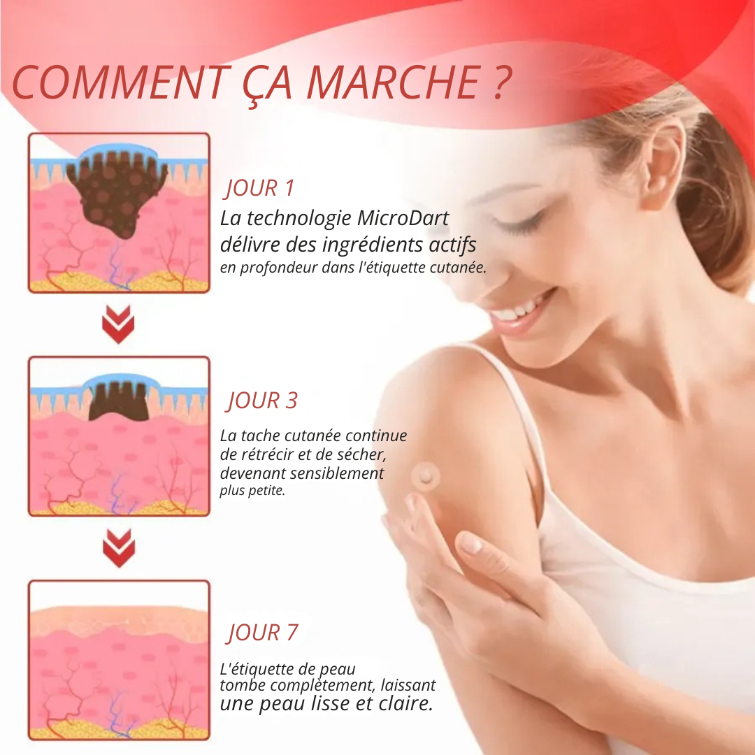 DermaPatch™ | Enlever les grains de beauté pendants sans douleur - pas de cicatrices, pas de coupures, pas de stress !