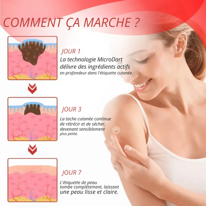 DermaPatch™ | Enlever les grains de beauté pendants sans douleur - pas de cicatrices, pas de coupures, pas de stress !