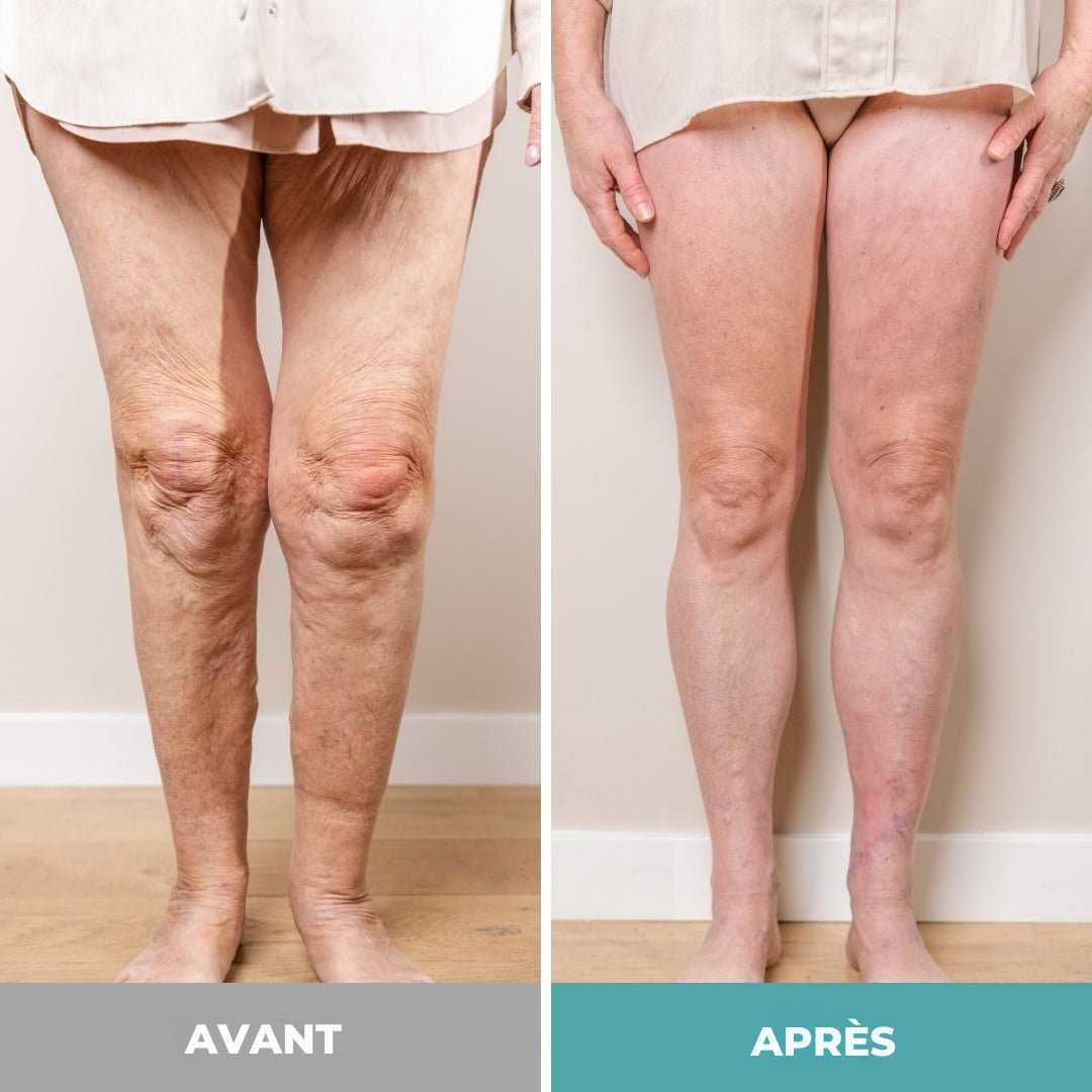 ReliveX™ | Appareil de massage pour les pieds pour une détente ultime