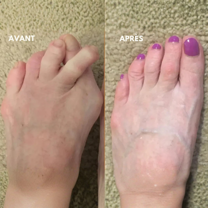 AlignOrteil™ | Rétablissez l'équilibre naturel de vos pieds sans intervention