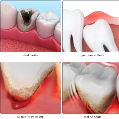 DentaSoulage™ | Soulagez la douleur et l'irritation en quelques minutes – naturellement et en toute sécurité