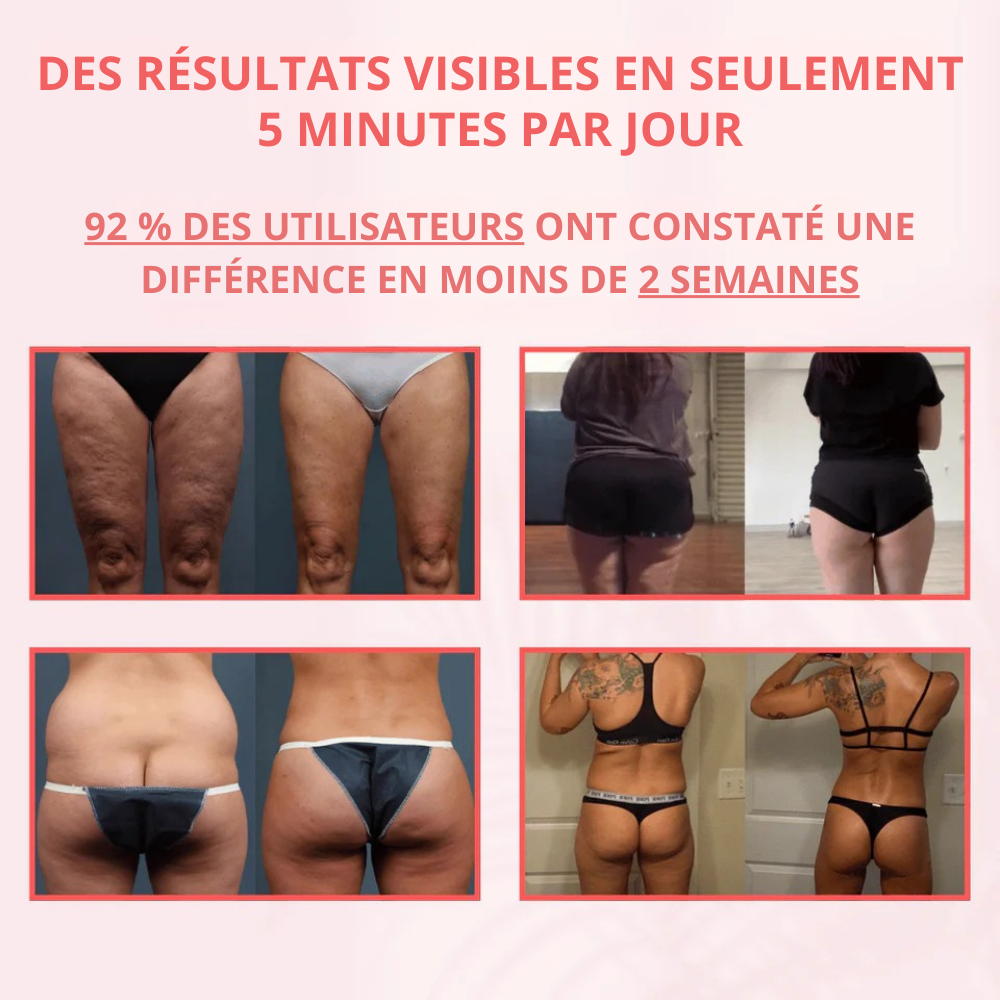 CelluSculpt™ | Appareil de massage 4 en 1 avec ventouses, infrarouge et chaleur – réduit visiblement la cellulite et les vergetures