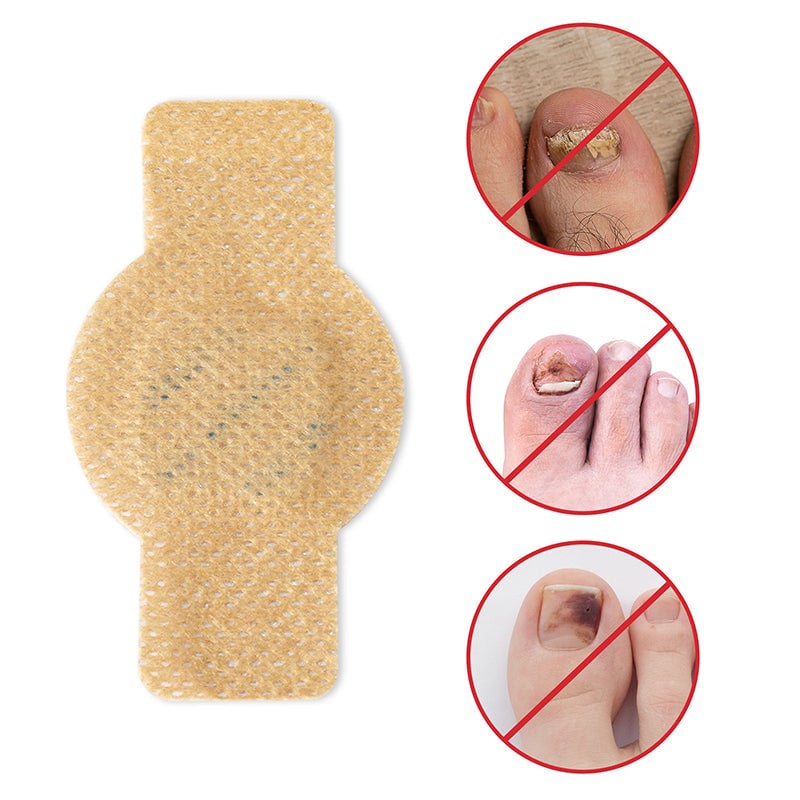 NailRepair™ | Pansement contre les mycoses des ongles