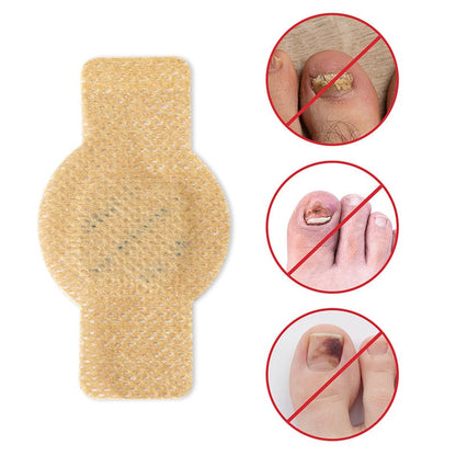 NailRepair™ | Pansement contre les mycoses des ongles